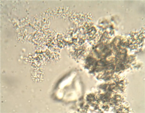 Bacterial Cells that aggregate in Floc